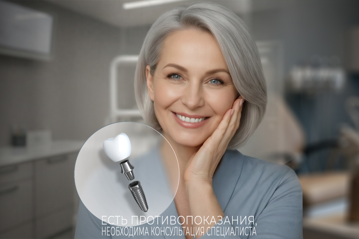 Потеряли зуб? Кость начинает убывать уже через 3–6 месяцев